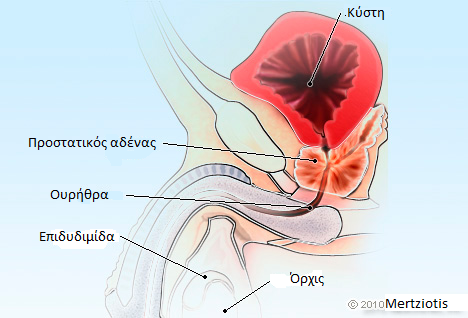 ΜΕΡΤΖΙΩΤΗΣ ΝΙΚΟΛΑΟΣ