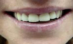 ΓΚΟΓΚΑΣ ΕΥΑΓΓΕΛΟΣ